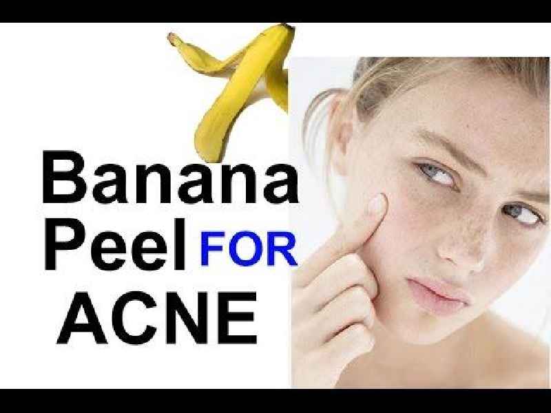 Do bananas help acne