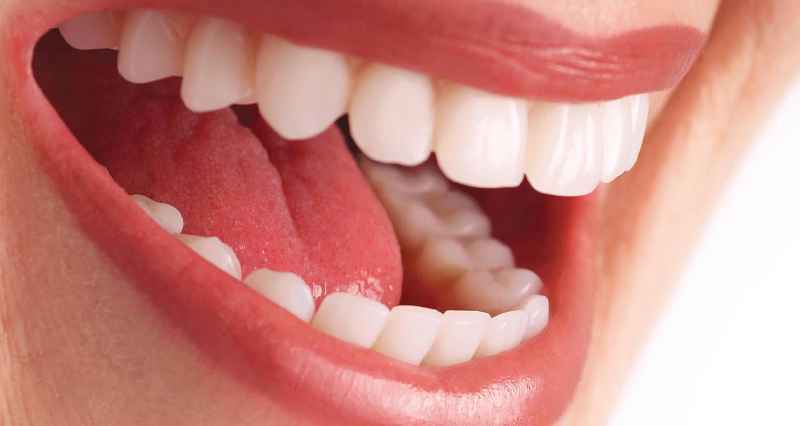 Do dentists have good oral hygiene