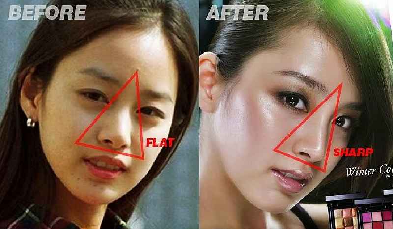 Do Korean teens get plastic surgery