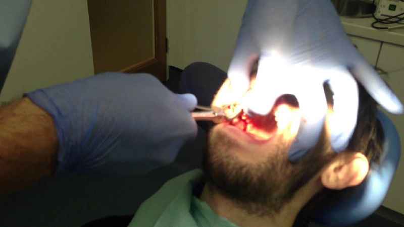 Do prosthodontists pull teeth
