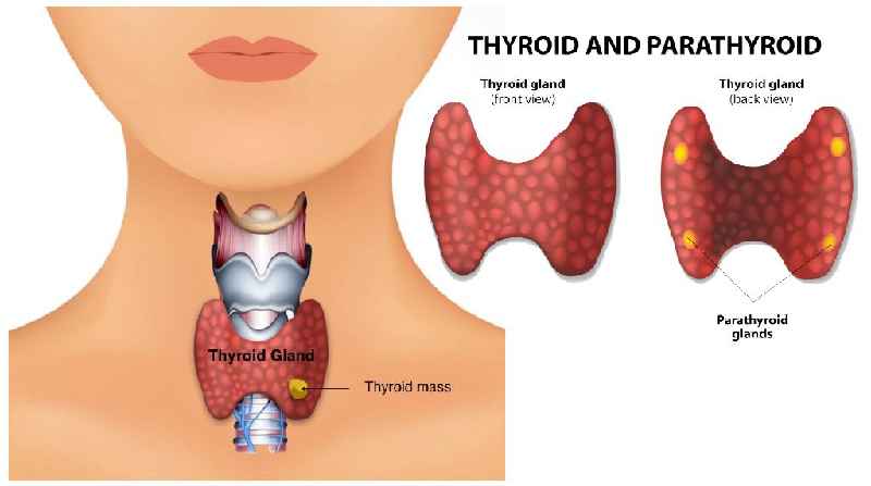 Do thyroid issues cause hair loss
