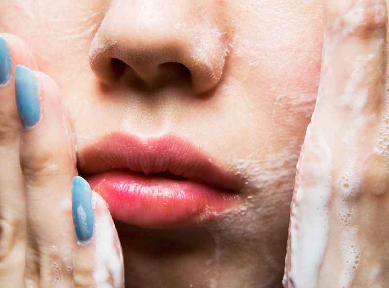 Do you wash your face after a chemical peel