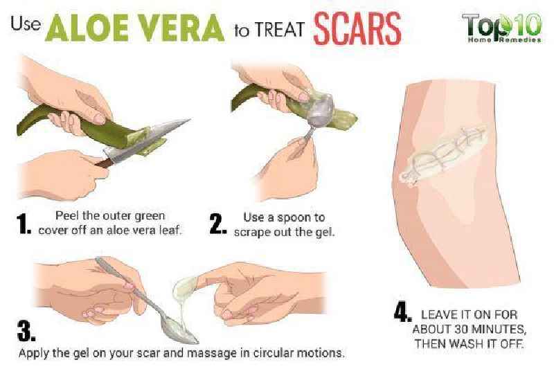 Does Aloe Vera repair damaged skin