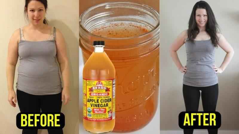 Does apple cider and vinegar help you lose weight