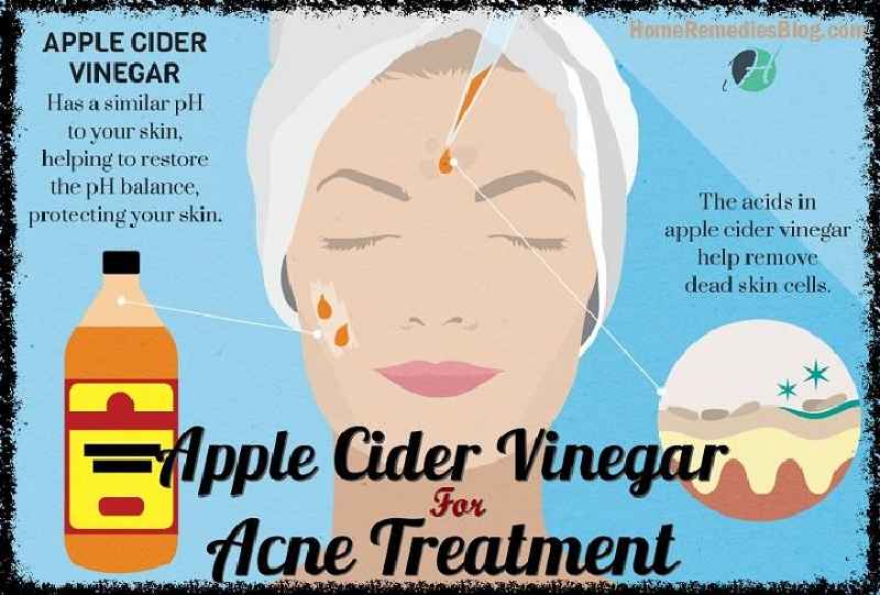 Does apple cider vinegar help acne scars