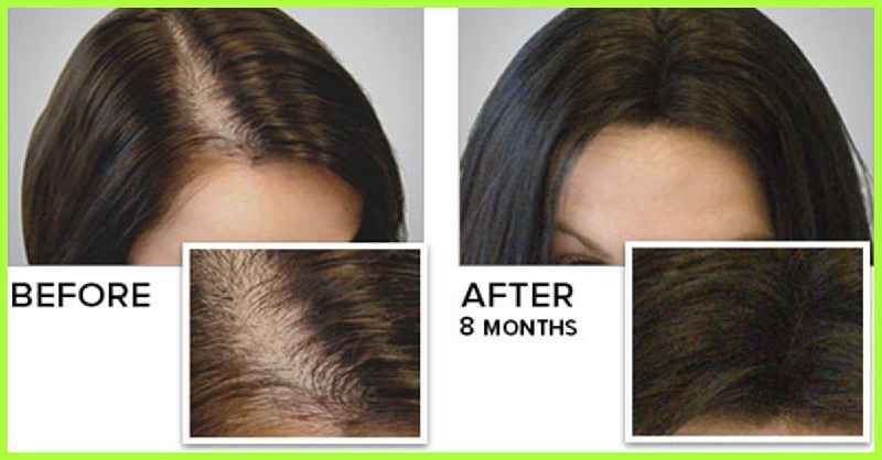 Does biotin help hair growth