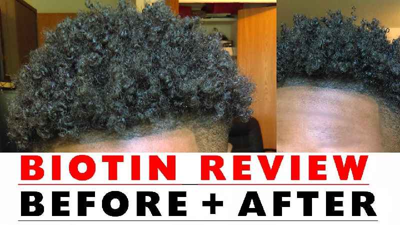 Does biotin thicken hair