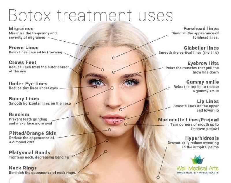 Does Botox make you prettier