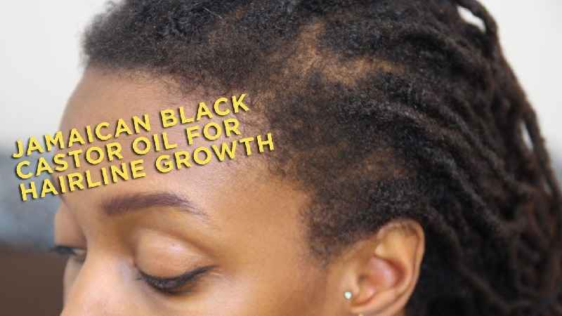Does castor oil grow hair