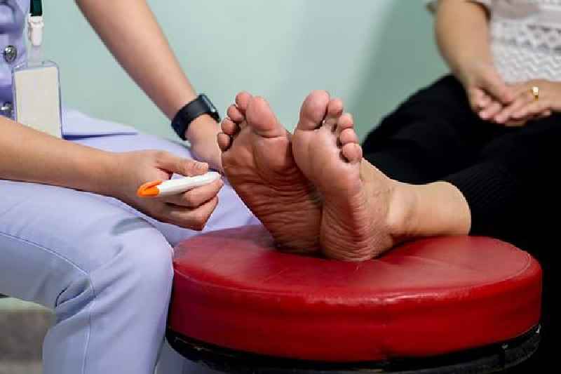 Does diabetes affect toenails