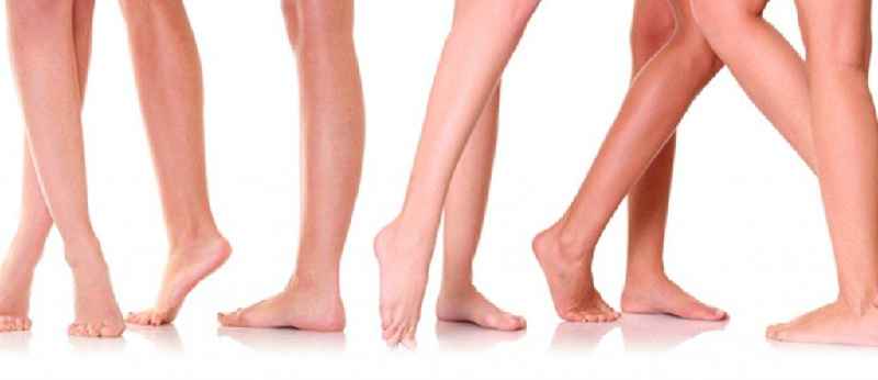 Does drinking water help varicose veins