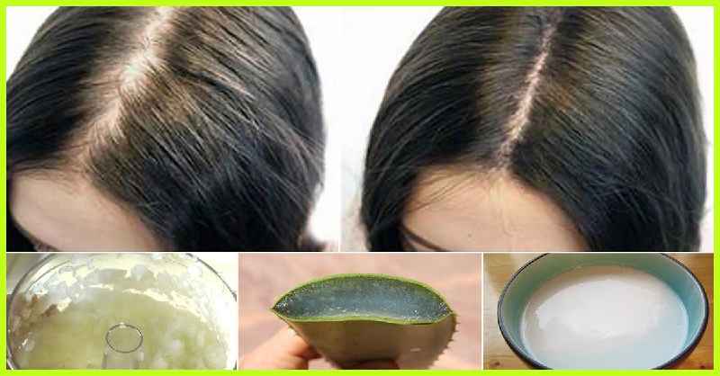 Does hair grow back thicker after electrolysis