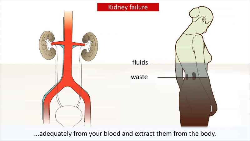 Does Herbalife damage your kidneys