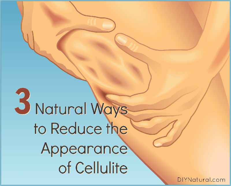 Does hydromassage get rid of cellulite