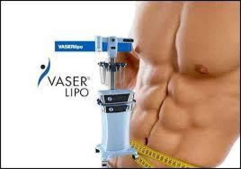 Does lipo permanently remove fat