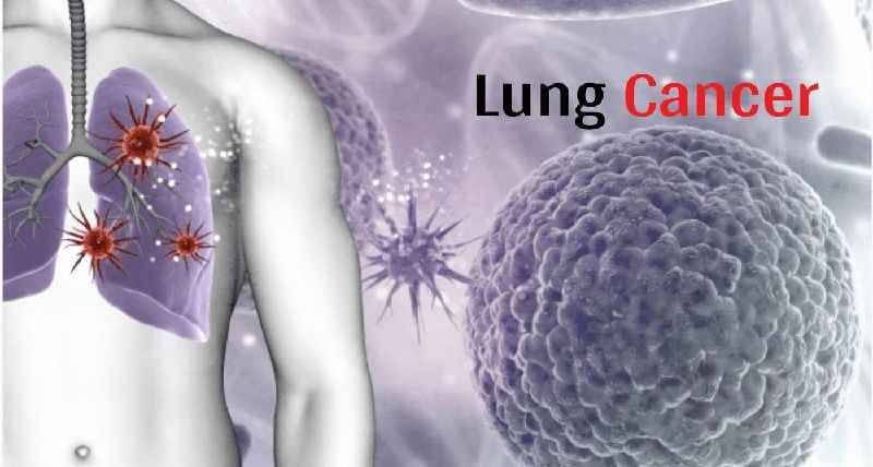 Does lung cancer cause you to lose weight