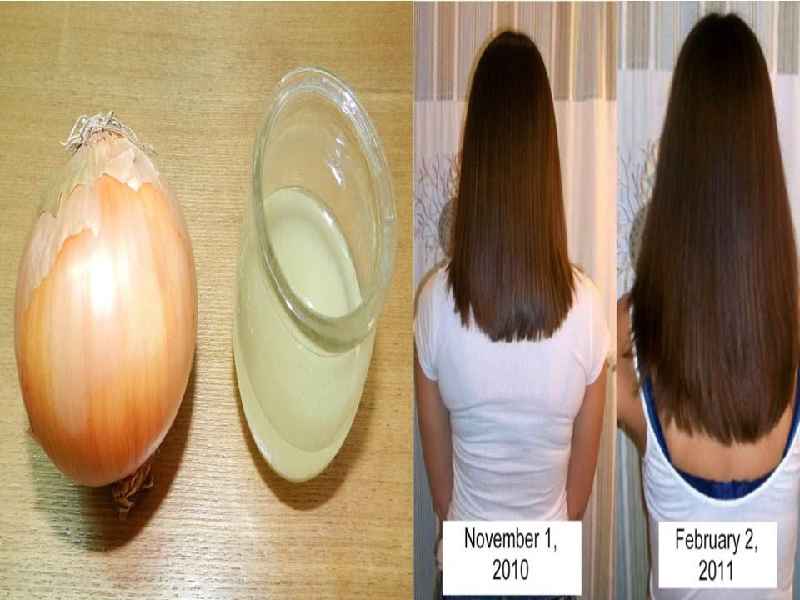 Does magnesium help with hair growth
