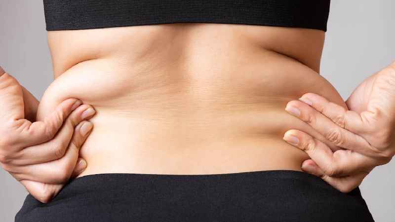 Does Medicare pay for tummy tuck after weight loss