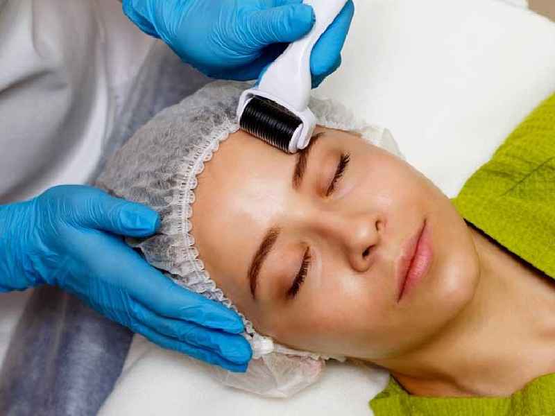 Does microneedling help pores