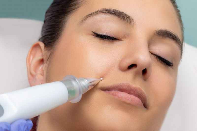 Does Nuface stimulate collagen production