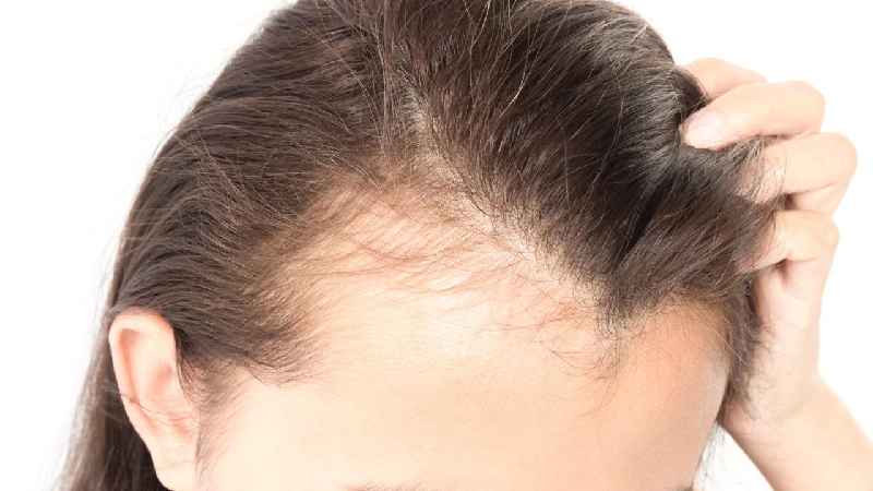 Does oiling hair cause hair fall