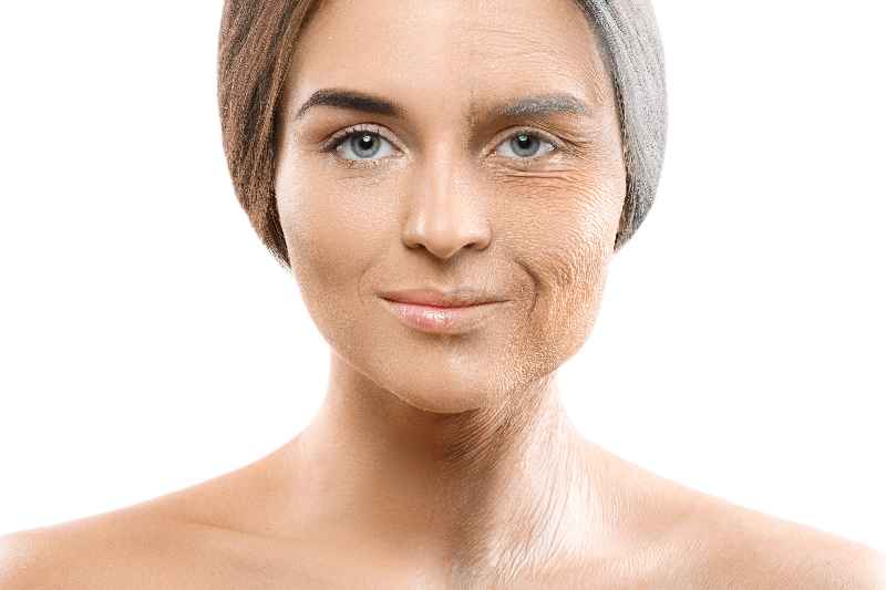 Does oily skin change with age
