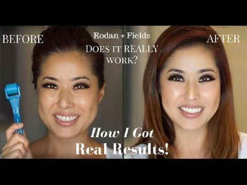 Does Rodan and Fields spotless really work
