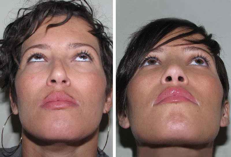 Does the NHS pay for plastic surgery