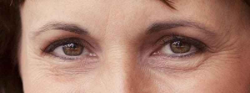 Does Vaseline help wrinkles Under eyes