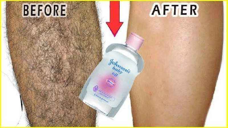 How body hair can be removed permanently