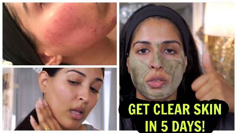 How can I clear my skin in 5 days