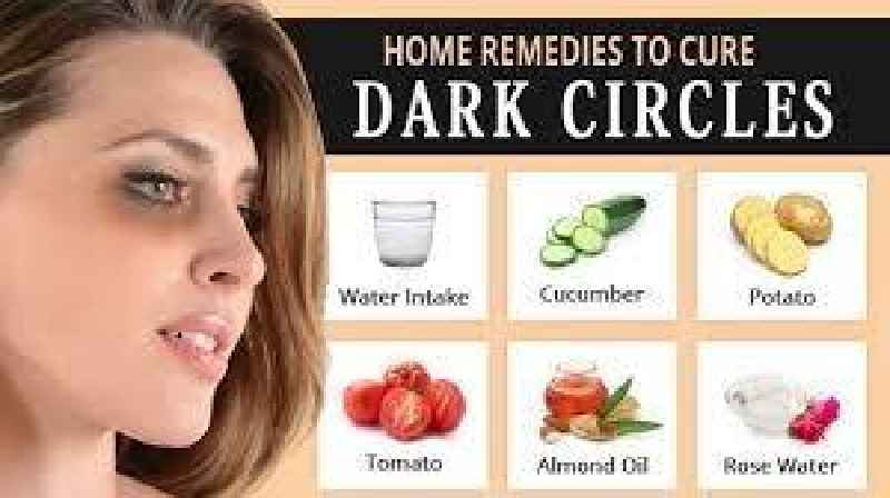 How can I get rid of dark circles in 2 days permanently