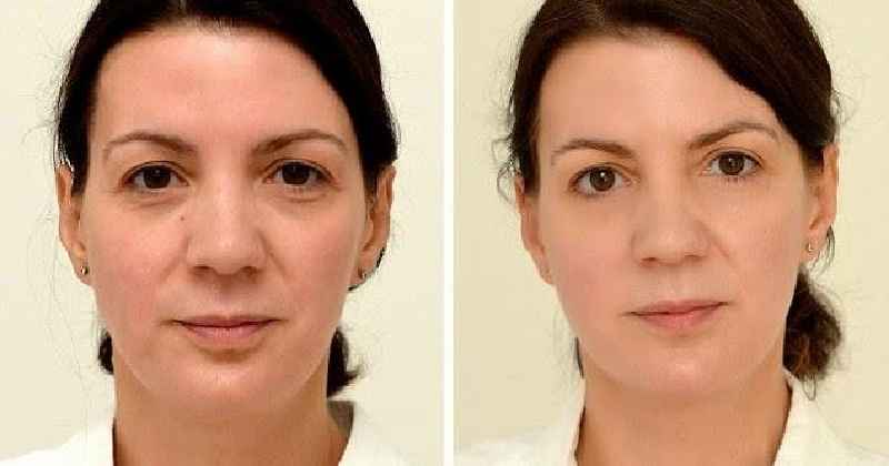 How can I make my face look younger naturally