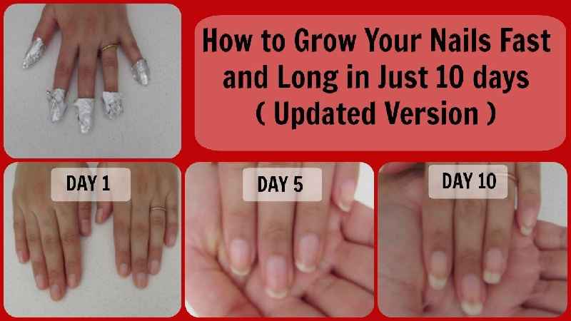 How can I make my toenails healthy again