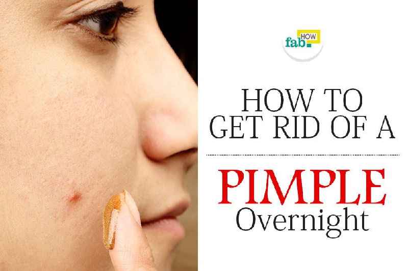 How can I remove pimples