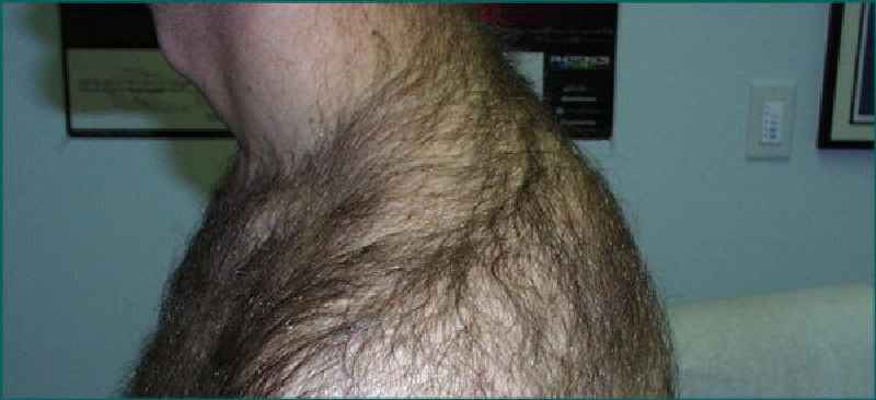 How can I remove whole body hair at home