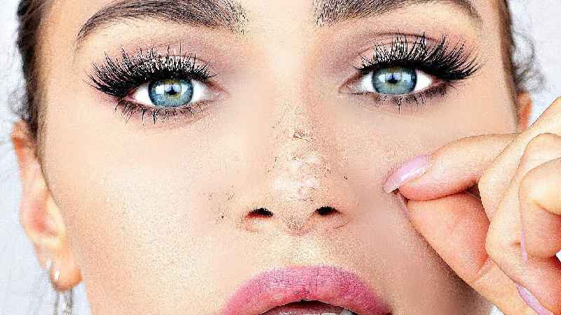 How can I treat dry skin on my face naturally