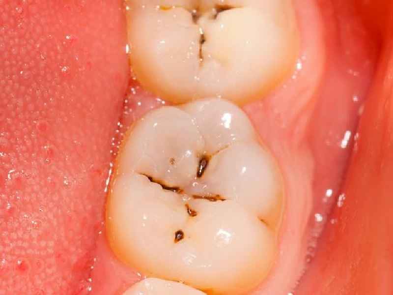How can you keep your teeth healthy without going to the dentist