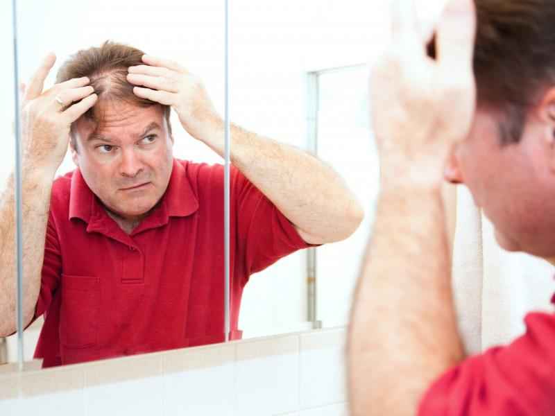 How can you tell if hair loss is genetic or stress