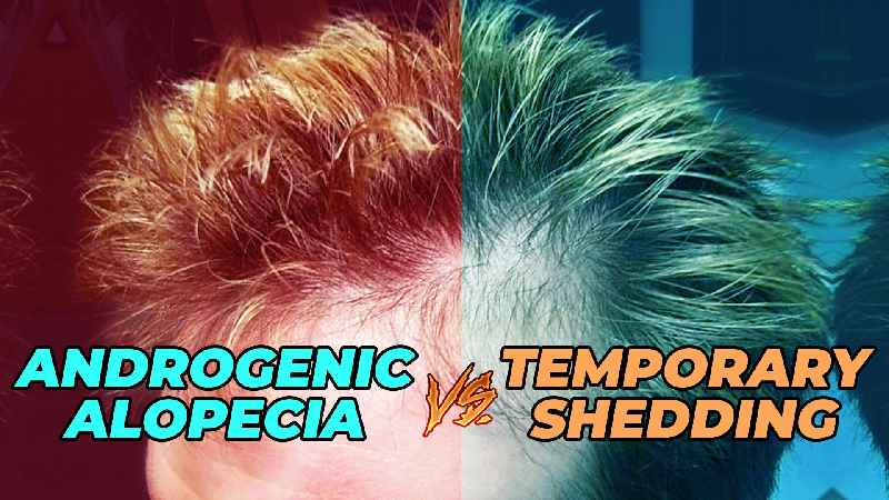 How can you tell the difference between hair loss and shedding