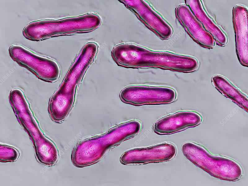 How common is Clostridium botulinum