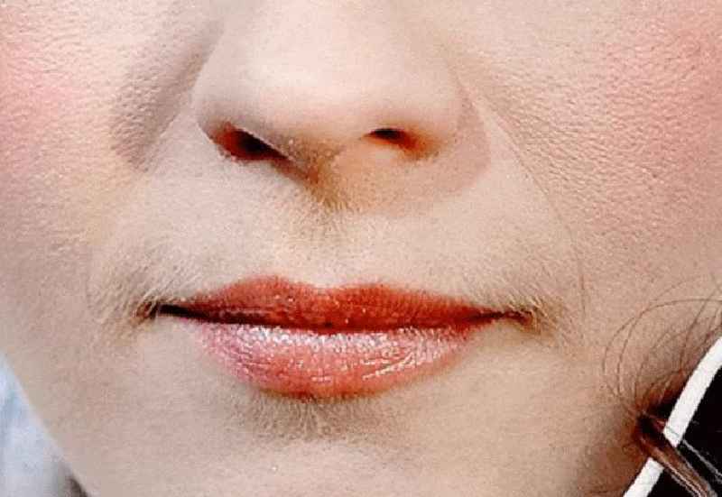 How do celebrities remove facial hair