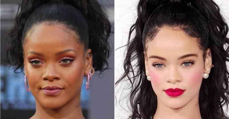 How do celebrities remove facial hair