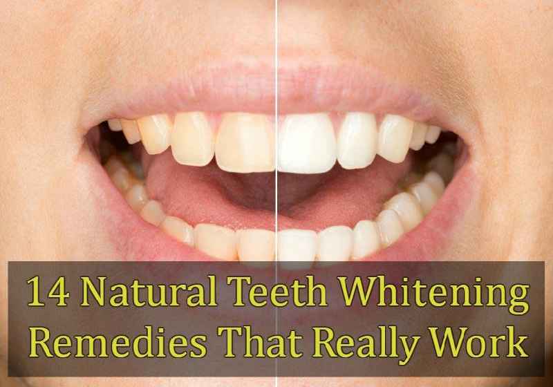 How do celebrities whiten their teeth