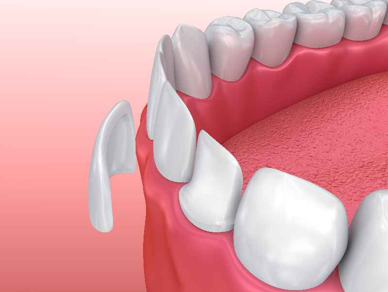 How do I know if I need cosmetic dentistry