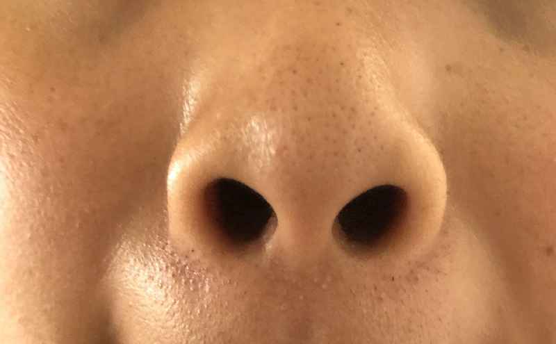 How do I permanently get rid of blackheads on my nose