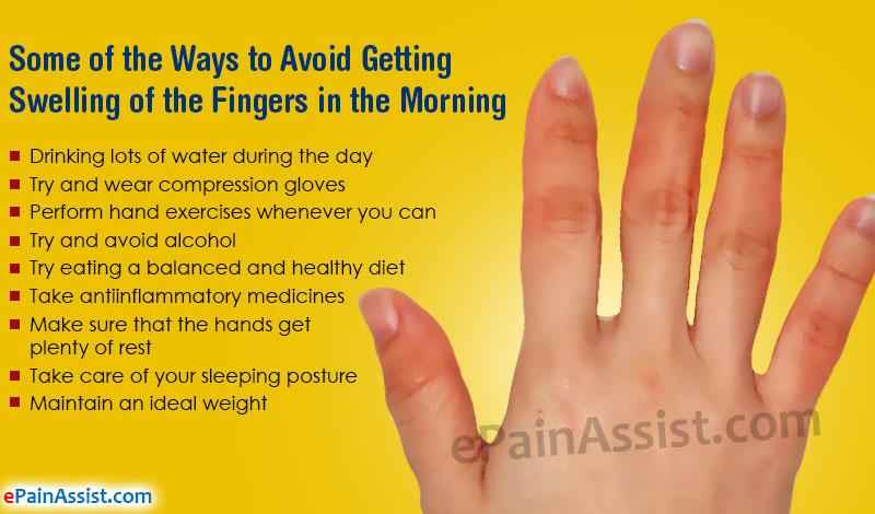 How do I stop my fingers from deforming with arthritis