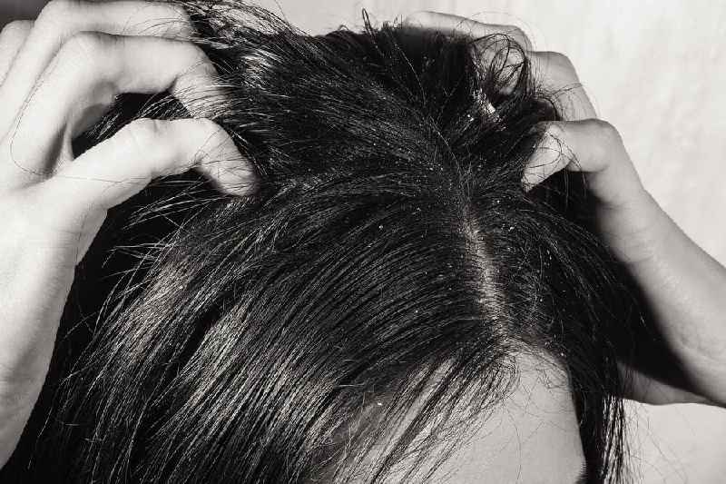 How do I wake up dormant hair follicles