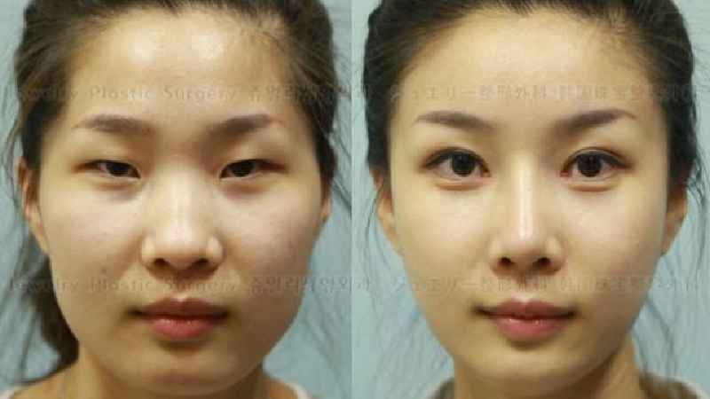 How do people afford cosmetic procedures