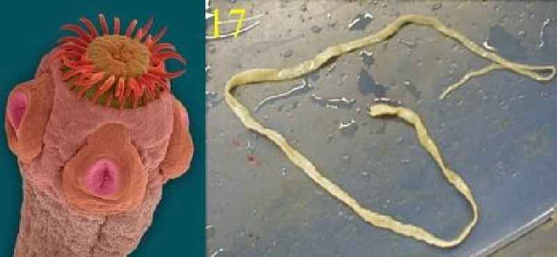 How do worms differ from viruses
